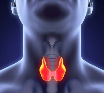 рак щитовидной железы