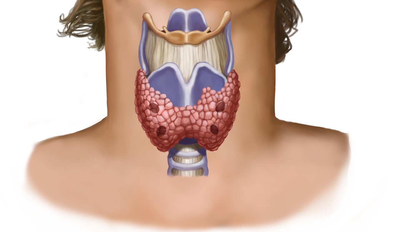 Щитовидная железа лечение у мужчин и профилактика